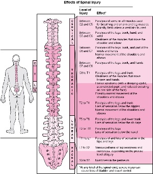 хвороби в тілі, пов'язані з ушкодженнями різних відділів хребта